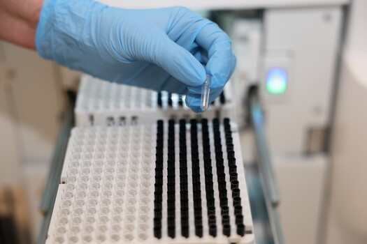 Foto Hand mit blauem Handschuh