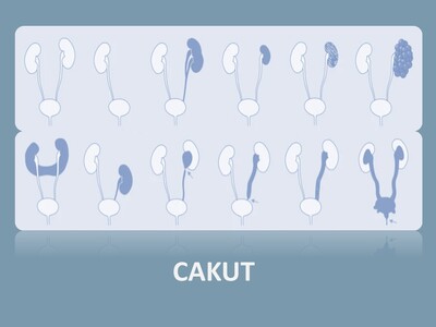 Schematische Darstellung der Angeborenen Fehlbildungen der Nieren und des ableitenden Harntraktes